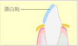 ホワイトニング剤について