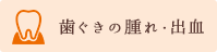 歯ぐきの腫れ・出血