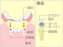 アタッチメント