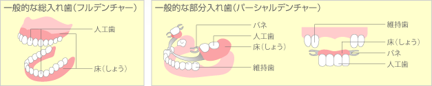 入れ歯の形状