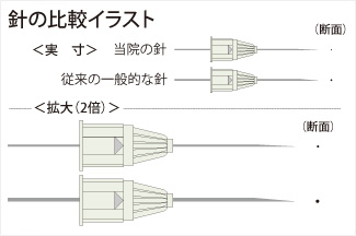 痛みの少ない細い針を使用しています