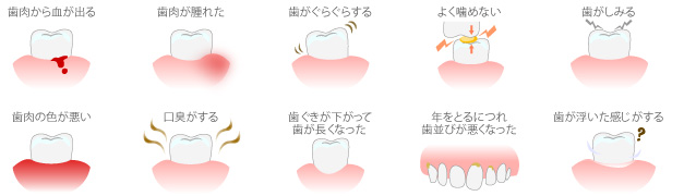 「もしかして歯周病？」と思ったらセルフチェック