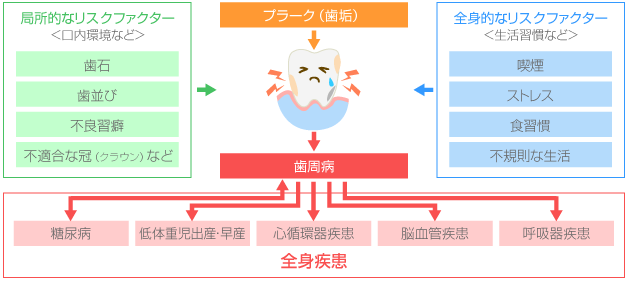 歯周病が身体にもたらす悪影響