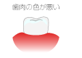 歯肉の色が悪い