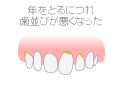 年をとるにつれ歯並びが悪くなった