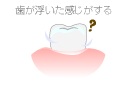 歯が浮いた感じがする