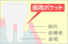 GTR法