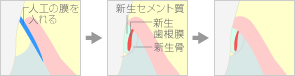 GTR法を用いた場合